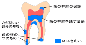 MTAZg