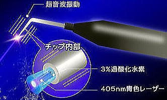 歯周病治療器