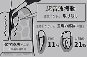 従来の歯周病治療