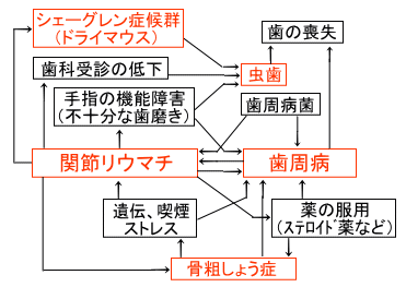 歯周病と関節リウマチの関係