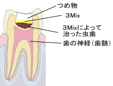 3Mix@S