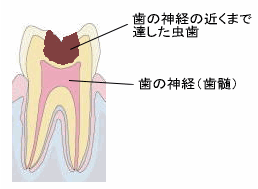 3Mix法　１