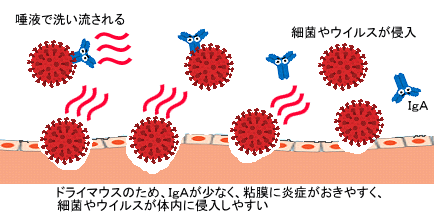 ドライマウス