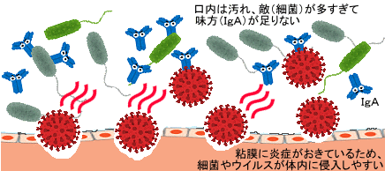 口内の汚れ