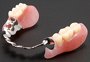 金属床義歯とエステショットの組み合わせ