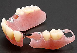 あちこちの歯が失われた複雑なケース