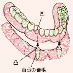�傫�ȓ��ꎕ