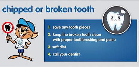 chipped or broken tooth